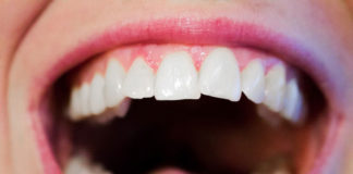 Stosowanie nici dentystycznej - wymysł czy obowiązek